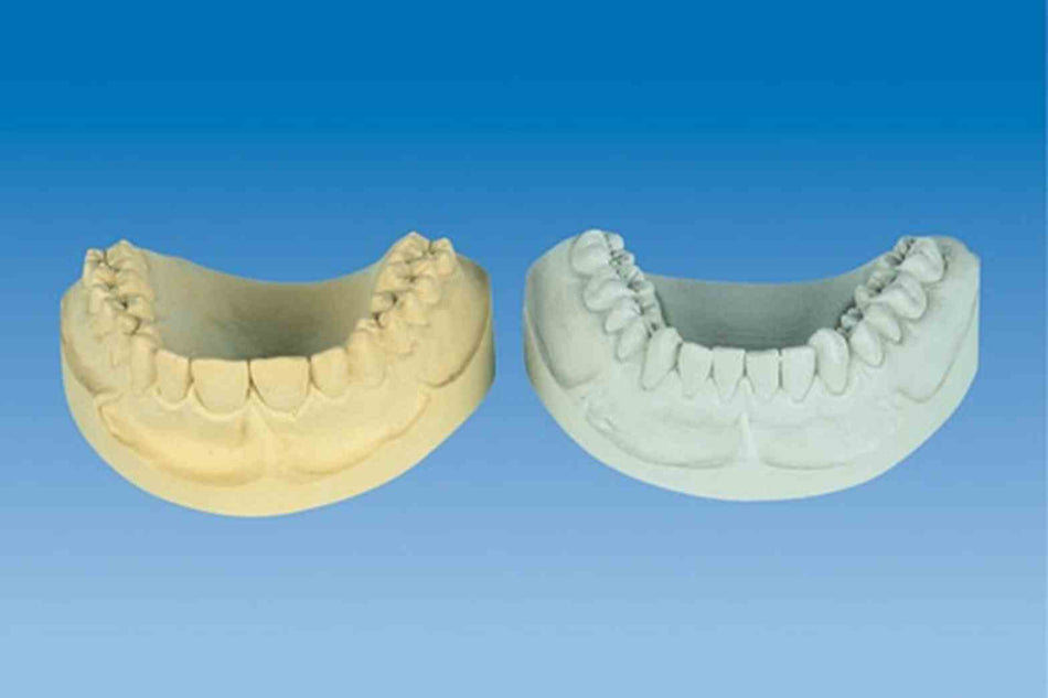 HARTGIPS N100 BRILLIANT-WHITE 18KG