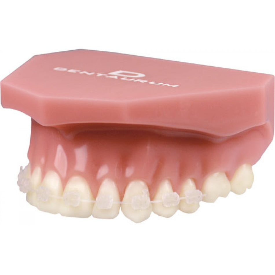 Orthodontic demonstration model discovery pearl, 1 piece