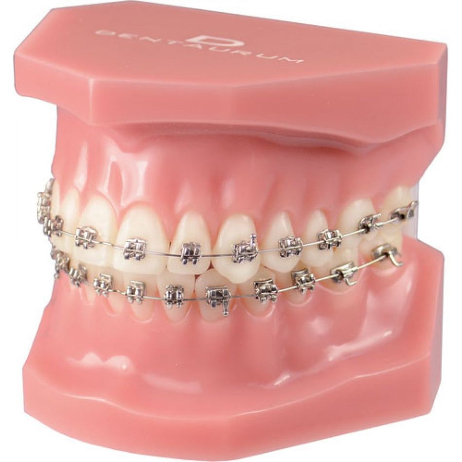 Discovery smart orthodontic demonstration model, 1 piece